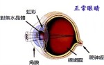 正常眼晴